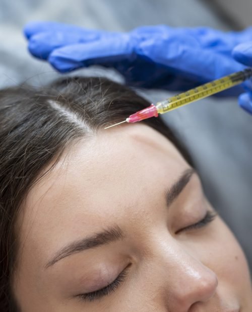 close-up-young-woman-getting-prp-injection